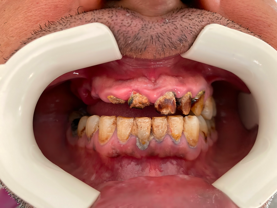 Rabident Acıbadem Dental Clinic Rabident Acıbadem Dental Clinic