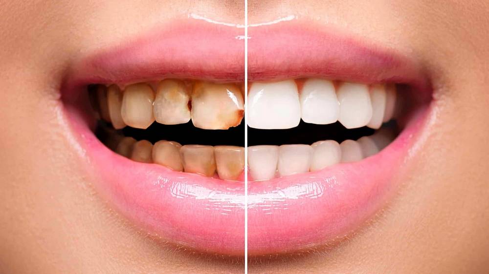 Rabident Acıbadem Dental Clinic